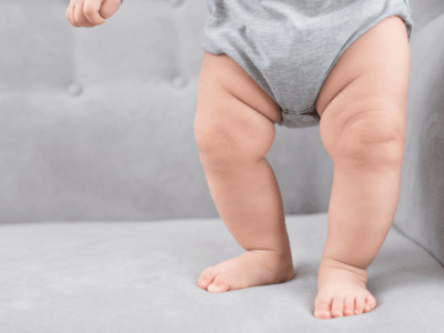 Çocuklarda O Bacak (Genu Varum) Nedir? Belirtileri, Nedenleri ve Tedavi Yöntemleri
