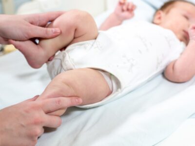 Bebeklerde Sık Görülen Ortopedik Problemler ve Tedavileri