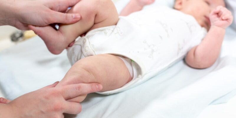 Yenidoğan Bebeklerde Sık Görülen Ortopedik Problemler